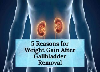 5 Reasons for Weight Gain After Gallbladder Removal