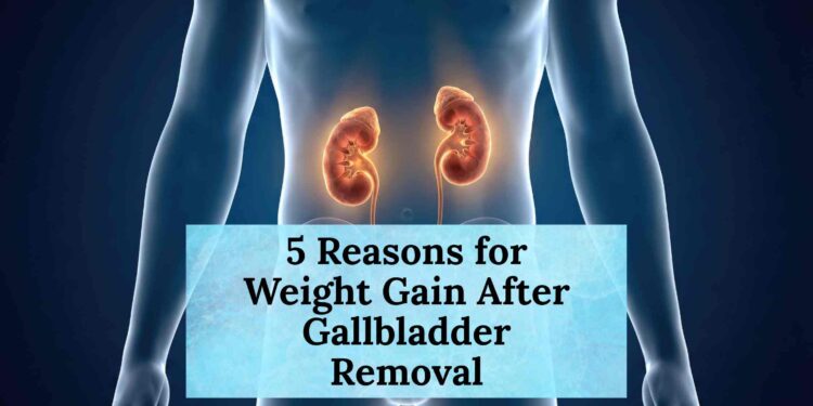 5 Reasons for Weight Gain After Gallbladder Removal